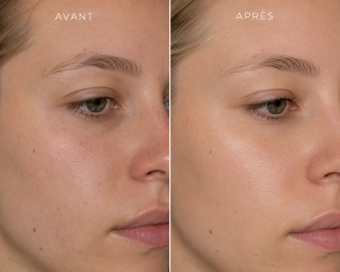Soin visage Purifiant